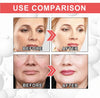 SuperSkin™ - Anti Aging Serum | 1+1 GRATIS!